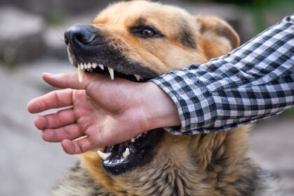 Dog Bite Lawsuit