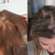 Olaplex Lawsuit