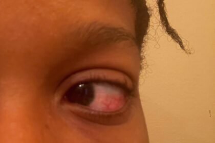 EZContacts Lawsuit