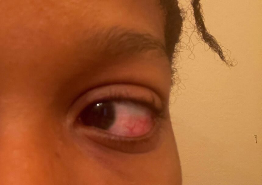 EZContacts Lawsuit